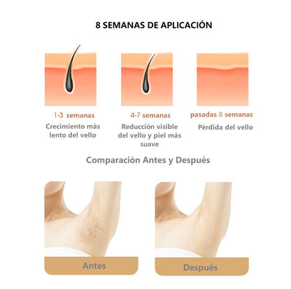 DEPILADORA SOFTSKIN® TECNOLOGÍA IPL + ENVÍO GRATIS